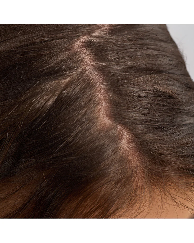 Kitsch Strengthening Hair & Scalp Oil - Image 4